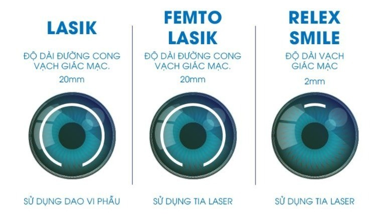 Review mổ mắt cận: Chi phí, nơi mổ, độ an toàn, quy trình (22) Review mổ mắt cận chi phí nơi mổ độ an toàn quy trình - Ảnh 5