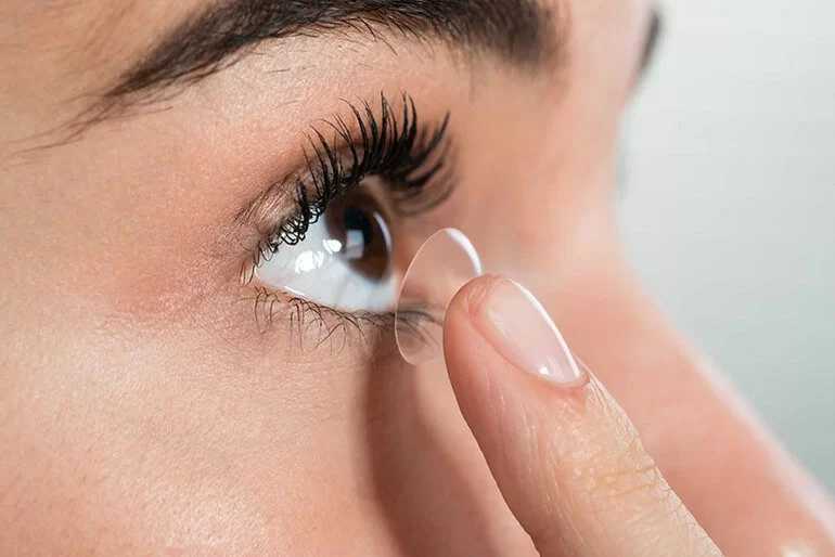 Bắn mắt cận có hại không, giá bao nhiêu, cần lưu ý gì? (20) Bắn mắt cận có hại không, giá bao nhiêu cần lưu ý gì - Ảnh 19
