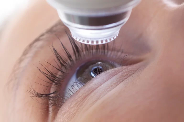 Loạn thị có tự khỏi không, cách chữa trị hiệu quả tại nhà - Ảnh 6