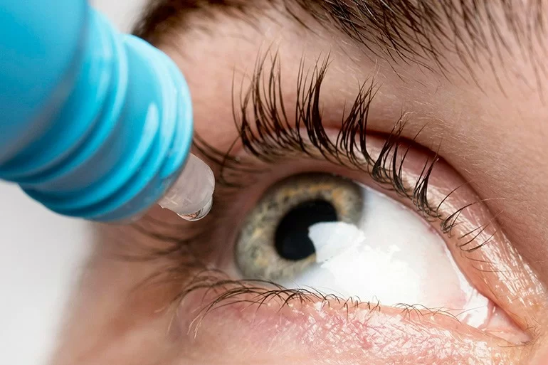 Mắt bị loạn thị có mổ được không, giá bao nhiêu, 5 rủi ro (28) Mắt bị loạn thị có mổ được không, giá bao nhiêu, 5 rủi ro - Ảnh 12