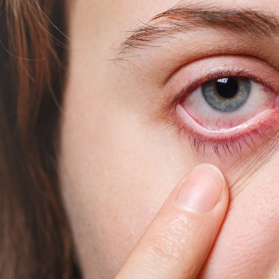 Contact lens là gì, có hại không, hãng nào tốt, giá, nơi mua (9) Contact lens là gì, có hại không, hãng nào tốt, giá, nơi mua - Ảnh 4