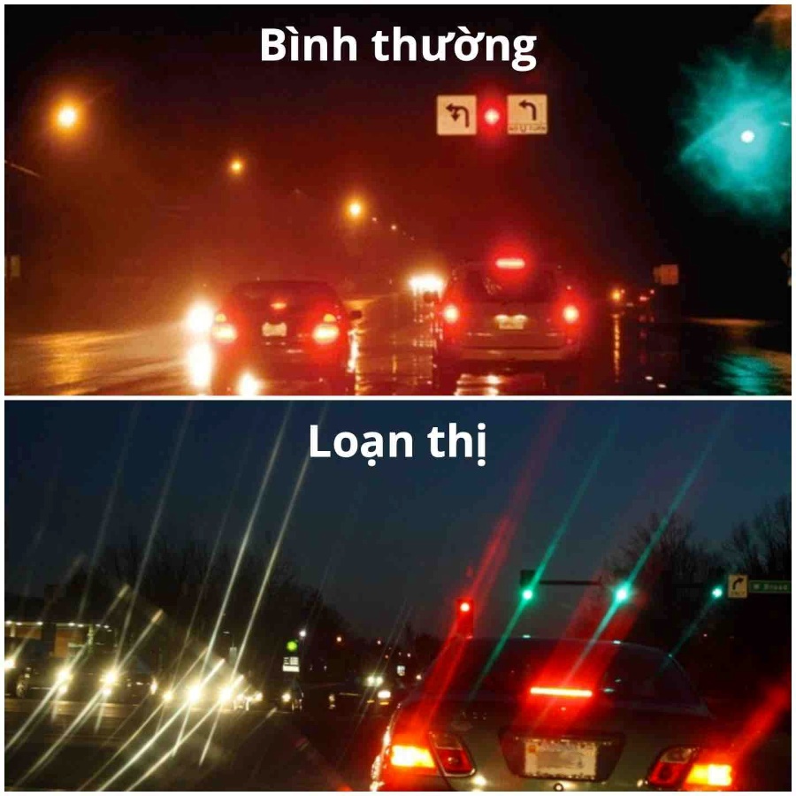 Loạn thị: Nguyên nhân, triệu chứng, chẩn đoán và điều trị (4) Hình ảnh bị biến dạng, có bóng mờ