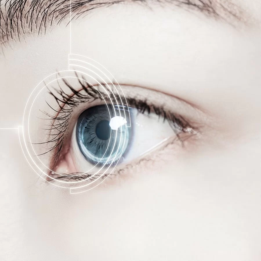 Những điều cần biết về kính áp tròng (Contact Lens) - Ảnh 8