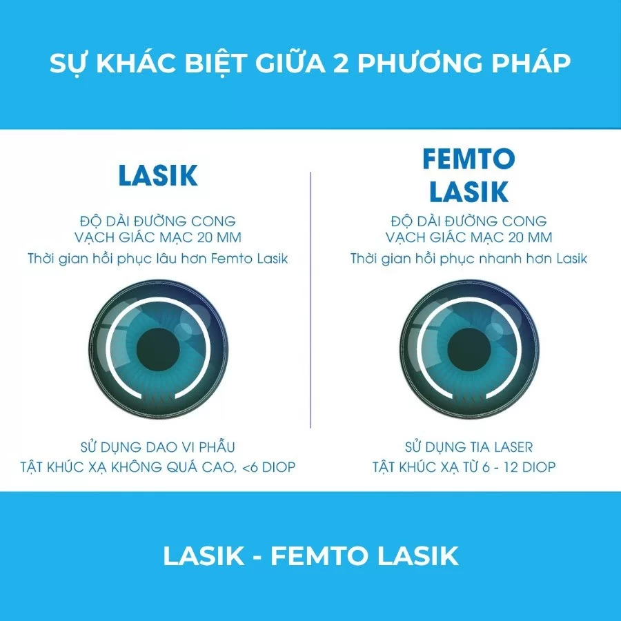 So sánh các loại mổ mắt cận hiện nay: Loại nào tốt nhất? (2) So sáng hai phương pháp mổ cận LASIK và FEMTO LASIK