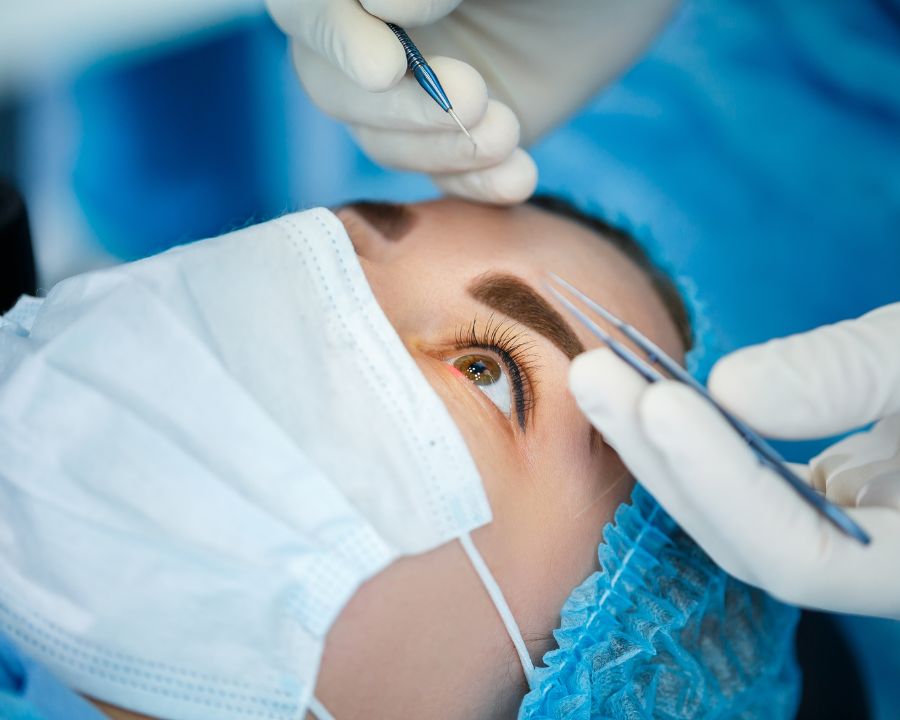 Mắt cận 10 độ có mổ được không? Phương pháp, chỉ định bác sĩ (4) Phẫu thuật SMILE Pro AI 4.0 không tạo vạt giác mạc, giảm nguy cơ biến chứng liên quan đến vạt