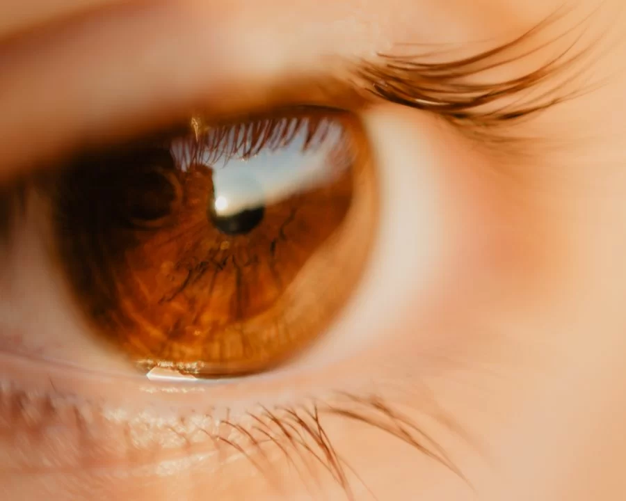 Mắt lồi do cận thị có chữa được không? Bác sĩ giải đáp A-Z