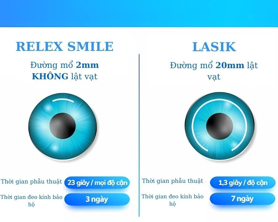 Mổ cận Relex Smile: Phương pháp, chi phí, điều kiện xóa cận (3) So sánh hai phương pháp mổ cận Relex Smile và Lasik