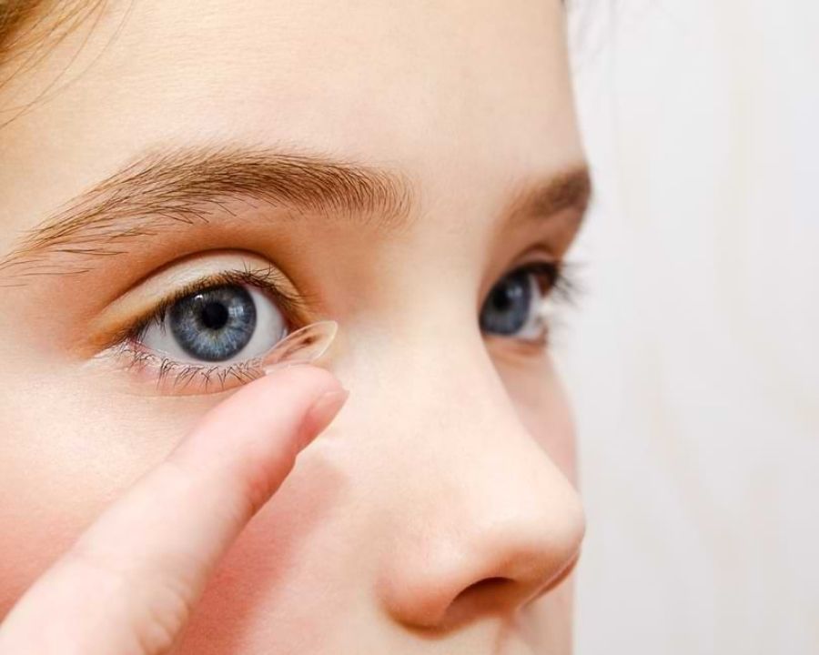 3 Cách kiểm soát cận thị cho trẻ được chuyên gia khuyến nghị (4) Đeo kính áp tròng ban đêm Ortho-K cho trẻ