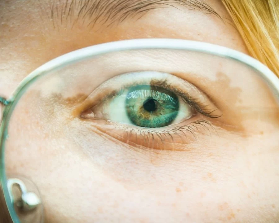 Diop (Đi ốp) là gì? Ý nghĩa và cách tính độ cận thị của mắt