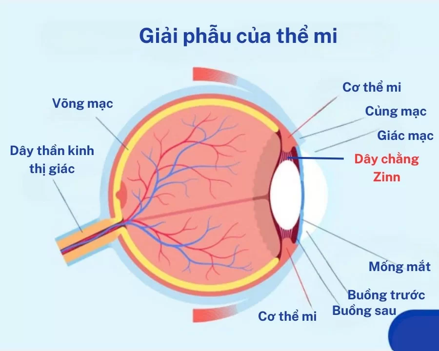 Viễn thị ở trẻ em là gì? Nguyên nhân, dấu hiệu và điều trị từ A tới Z (4) Dây chằng Zinn trong cấu trúc mắt - một trong những nguyên nhân gây viễn thị