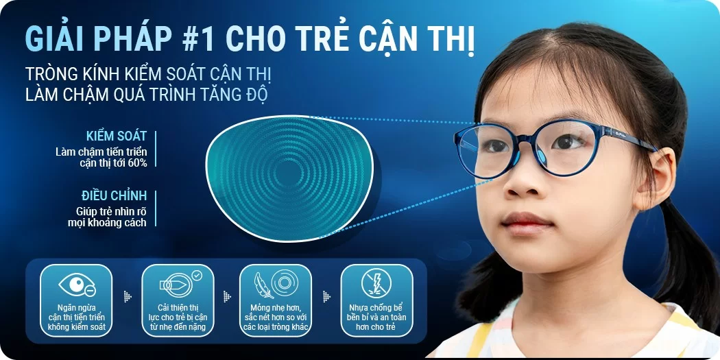 Tròg kính kiểm soát cận thị: Giải pháp số 1 cho trẻ
