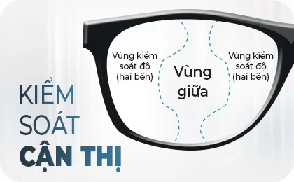 Tròng kính kiểm soát cận thị