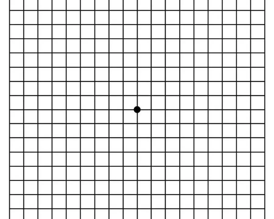 Bảng kiểm tra thị lực Amsler Grid