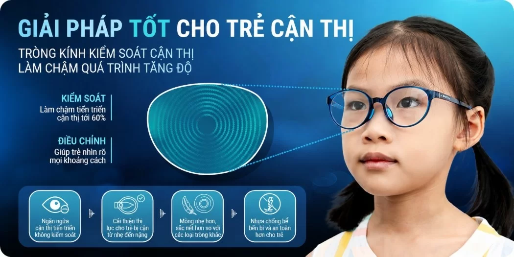 Tròng kính kiểm soát cận thị: Giải pháp bảo vệ mắt tốt cho trẻ em