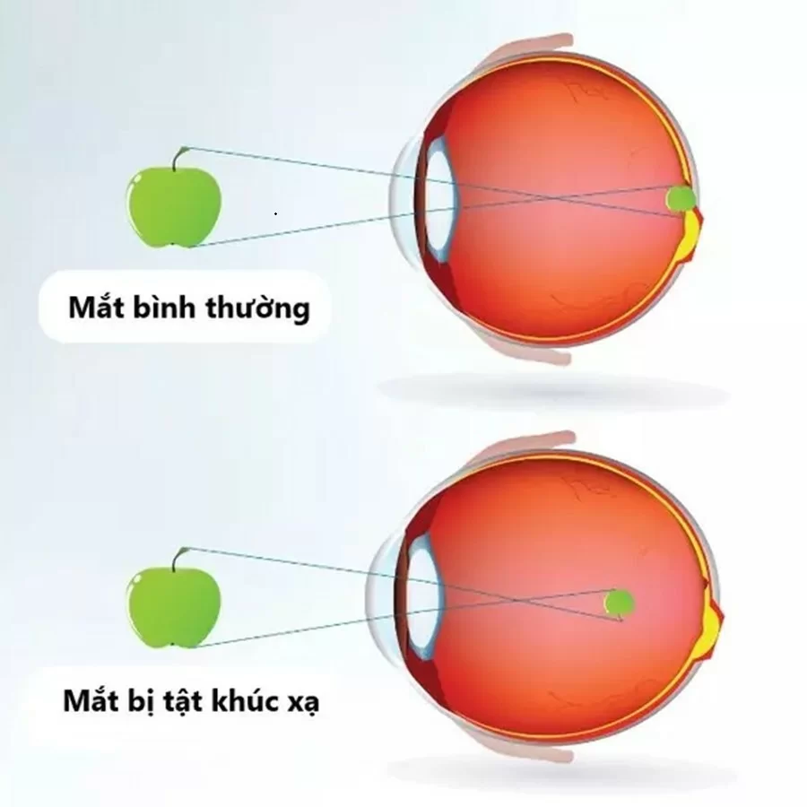 kinh chong anh sang xanh la gi co nen deo 5 luu y nen nho 3